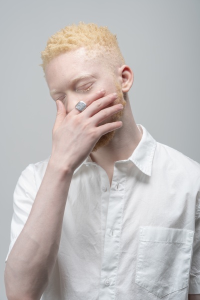retrato de estudio de hombre albino