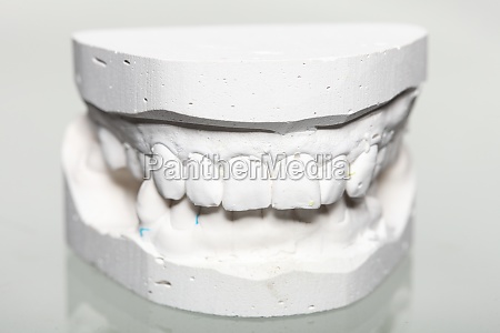 dental yeso modelo de molde de los dientes en yeso - Stockphoto #11677030 |  Agencia de stock PantherMedia